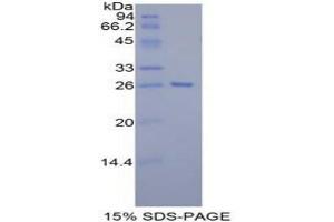 SDS-PAGE analysis of Mouse Tafazzin Protein.