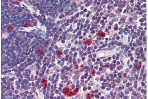 Immunohistochemistry (Formalin-fixed Paraffin-embedded Sections) (IHC (fp)) image for anti-Caspase 9, Apoptosis-Related Cysteine Peptidase (CASP9) (AA 299-318) antibody (ABIN462427)