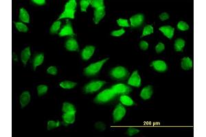 Immunofluorescence of monoclonal antibody to CHUK on HeLa cell. (IKK alpha antibody  (AA 646-745))