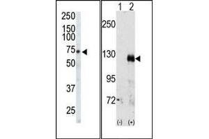 (LEFT)Western blot analysis of anti-EphA3 Pab in CHO cell lysate. (EPH Receptor A3 antibody  (C-Term))