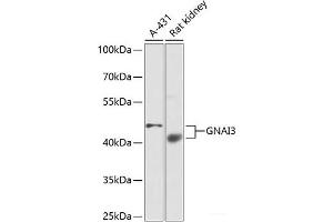 Western blot analysis of extracts of various cell lines using GNAI3 Polyclonal Antibody at dilution of 1:1000. (GNAI3 antibody)