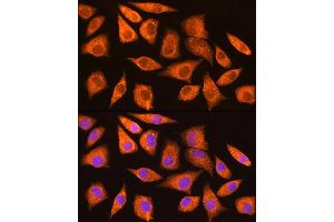 Immunofluorescence analysis of L929 cells using MDM2 antibody (ABIN6133186, ABIN6143671, ABIN6143672 and ABIN6217278) at dilution of 1:100. (MDM2 antibody  (AA 200-430))