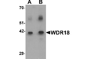 Western blot analysis of WDR18 in rat lung tissue lysate with WDR18 antibody at (A) 0. (WDR18 antibody  (C-Term))