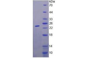 Image no. 1 for GM2 Ganglioside Activator (GM2A) (AA 24-193) protein (His tag) (ABIN6236452) (GM2A Protein (AA 24-193) (His tag))