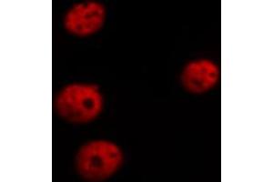 ABIN6267526 staining HepG2 cells by ICC/IF. (GATA4 antibody  (pSer105))
