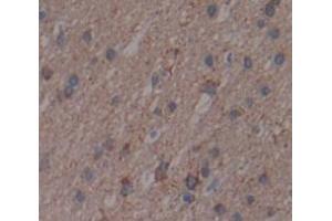 Figure. (DDO antibody  (AA 170-304))