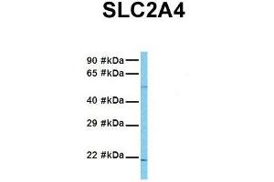 Host:  Rabbit  Target Name:  SLC2A4  Sample Tissue:  Human MCF7  Antibody Dilution:  1. (GLUT4 antibody  (N-Term))