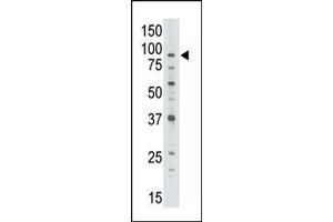 The anti-ABCB7 C-term Pab (ABIN390062 and ABIN2840589) is used in Western blot to detect ABCB7 in Jurkat cell lysate. (ABCB7 antibody  (C-Term))