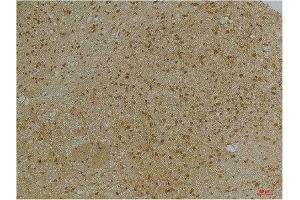 Immunohistochemical analysis of paraffin-embedded Mouse BrainTissue using KCNN2(SK2) Rabbit pAb diluted at 1:200. (KCNN2 antibody)