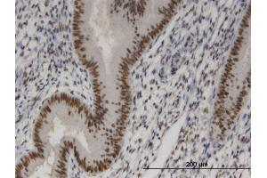 Immunoperoxidase of monoclonal antibody to SIX4 on formalin-fixed paraffin-embedded human endometrium. (SIX4 antibody  (AA 672-780))