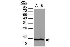 WB Image Sample(30 μg of whole cell lysate) A:MOLT4, B:Raji, 12% SDS PAGE antibody diluted at 1:3000 (H2AFZ antibody  (C-Term))