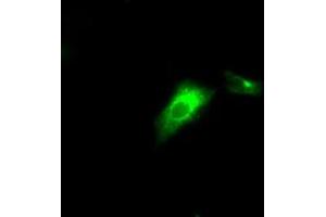 Image no. 6 for anti-Lipase, Endothelial (LIPG) antibody (ABIN1499169) (LIPG antibody)