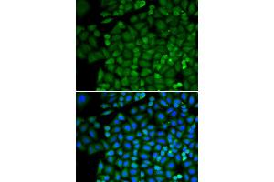 Immunofluorescence analysis of HeLa cell using SELENBP1 antibody. (SELENBP1 antibody)