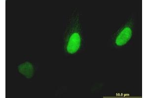 Immunofluorescence of monoclonal antibody to PUM2 on HeLa cell. (PUM2 antibody  (AA 106-205))