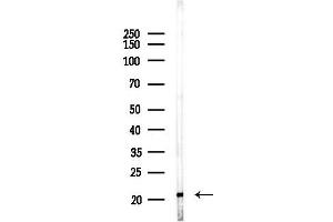 anti-CD8b Molecule (CD8B) (Internal Region) antibody