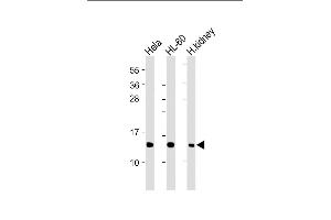 All lanes : Anti-ND4L Antibody (C-term) at 1:2000 dilution Lane 1: Hela whole cell lysate Lane 2: HL-60 whole cell lysate Lane 3: Human kidney lysate Lysates/proteins at 20 μg per lane.