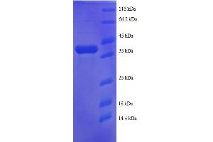 Ribosomal Protein S25 (RPS25) (AA 1-125), (full length) protein (GST tag) (RPS25 Protein (AA 1-125, full length) (GST tag))