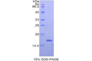 SDS-PAGE (SDS) image for Meningioma Expressed Antigen 5 (Hyaluronidase) (MGEA5) (AA 679-808) protein (His tag) (ABIN1878419)