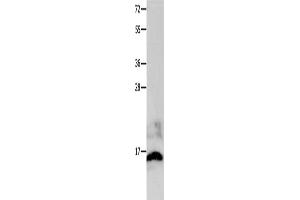 Gel: 12 % SDS-PAGE, Lysate: 40 μg, Lane: Mouse brain tissue, Primary antibody: ABIN7191217(KISS1 Antibody) at dilution 1/100, Secondary antibody: Goat anti rabbit IgG at 1/8000 dilution, Exposure time: 20 seconds (KISS1 antibody)
