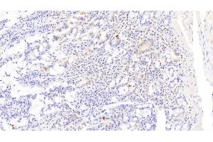 Detection of DR5 in Human Small intestine Tissue using Polyclonal Antibody to Death receptor 5 (DR5) (TNFRSF10B antibody  (AA 234-435))