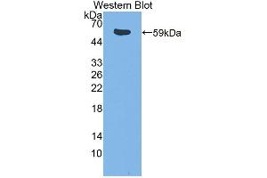 Western blot analysis of the recombinant protein. (ITK antibody  (AA 368-625))