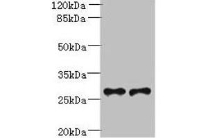 Western blot All lanes: Trem2 antibody at 6 μg/mL Lane 1: Mouse liver tissue Lane 2: THP-1 whole cell lysate Secondary Goat polyclonal to rabbit IgG at 1/10000 dilution Predicted band size: 25, 28 kDa Observed band size: 28 kDa (TREM2 antibody  (AA 19-171))