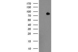 HEK293T cells were transfected with the pCMV6-ENTRY control (Left lane) or pCMV6-ENTRY ACSS2 (Right lane) cDNA for 48 hrs and lysed. (ACSS2 antibody)