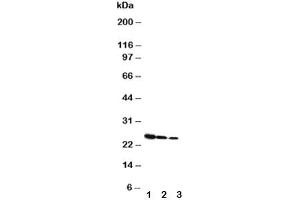 Western blot testing of Growth Hormone antibody and Lane 1:  Recombinant rat GH protein 10ng (Growth Hormone 1 antibody  (AA 27-216))