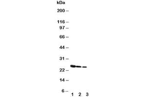 Western blot testing of Growth Hormone antibody and Lane 1:  Recombinant rat GH protein 10ng