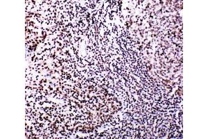 Immunohistochemistry (IHC) image for anti-V-Myb Myeloblastosis Viral Oncogene Homolog (Avian)-Like 2 (MYBL2) (N-Term) antibody (ABIN3029533)