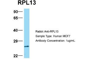Western Blotting (WB) image for anti-Ribosomal Protein L13 (RPL13) (C-Term) antibody (ABIN2778677)