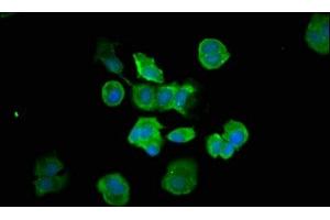 Immunofluorescence staining of MCF-7 cells with ABIN7146960 at 1:66, counter-stained with DAPI. (Caspase 7 antibody  (AA 24-198))