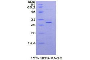 SDS-PAGE (SDS) image for Moesin (MSN) (AA 353-577) protein (His tag) (ABIN2125937)