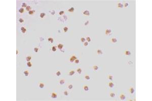 Immunocytochemistry staining of Daudi cells using AP30905PU-N at 2 μg/ml. (TLR7 antibody  (Middle Region))