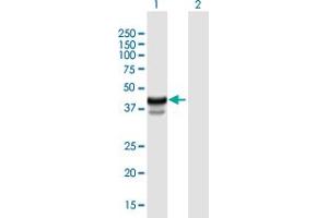 Western Blot analysis of HPR expression in transfected 293T cell line by HPR MaxPab polyclonal antibody. (HPR antibody  (AA 1-348))