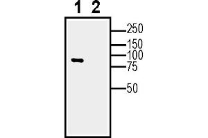 Western blot analysis of human  MG glioblastoma cell line lysate (lane 1) and  MG-derived purified exosomes (lane 2)50 μg of cells and purified exosomes lysates were analyzed using Anti-Calnexin Antibody (ABIN7043021, ABIN7044212 and ABIN7044213), (1:600).