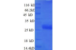 SDS-PAGE (SDS) image for Vascular Endothelial Growth Factor A (VEGFA) (AA 27-232) protein (His tag) (ABIN5712562) (VEGFA Protein (AA 27-232) (His tag))