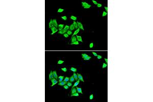 Immunofluorescence analysis of A549 cells using DNMT3A antibody (ABIN5973891). (DNMT3A antibody)