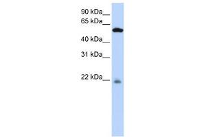 PM20D2 antibody used at 1 ug/ml to detect target protein. (PM20D2 antibody  (Middle Region))