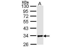 WB Image Sample (30 ug of whole cell lysate) A: Hela 10% SDS PAGE antibody diluted at 1:1000 (FHL1 antibody  (C-Term))