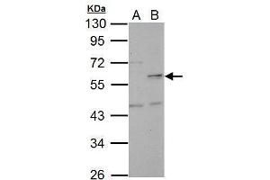 WB Image Sample (30 ug of whole cell lysate) A: HeLa B: HeLa nucleus 10% SDS PAGE antibody diluted at 1:5000 (NUF2 antibody)