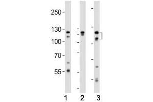 Western Blotting (WB) image for anti-Fibroblast Growth Factor Receptor 2 (FGFR2) (AA 7-37) antibody (ABIN3030951)