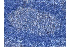 Immunohistochemical staining of paraffin-embedded Human lymph node tissue using anti-IVD mouse monoclonal antibody.