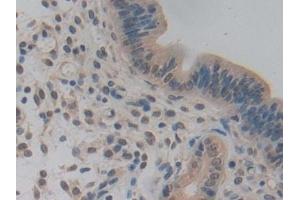 Detection of NUP85 in Mouse Uterus Tissue using Polyclonal Antibody to Nucleoporin 85 (NUP85)