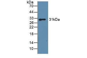 Detection of Recombinant GAL3, Mouse using Polyclonal Antibody to Galectin 3 (GAL3) (Galectin 3 antibody)