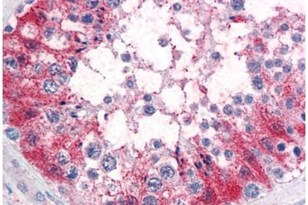 SRPX2 antibody  (Internal Region)