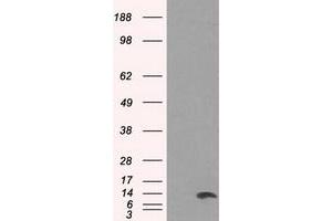 Image no. 1 for anti-Inhibitor of DNA Binding 3, Dominant Negative Helix-Loop-Helix Protein (ID3) antibody (ABIN1498778) (ID3 antibody)
