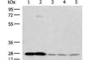Western blot analysis of Human cerebella tissue Human cerebrum tissue Human skin tissue NIH/3T3 cell SKOV3 cell lysates using OVOL2 Polyclonal Antibody at dilution of 1:350