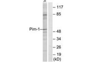 Western blot analysis of extracts from Jurkat cells, using Pim-1 (Ab-309) Antibody. (PIM1 antibody  (AA 281-330))