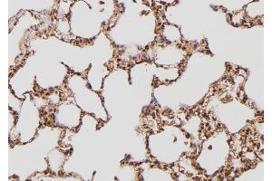 ABIN6274169 at 1/100 staining Rat lung tissue by IHC-P. (TPT1 antibody  (Internal Region))